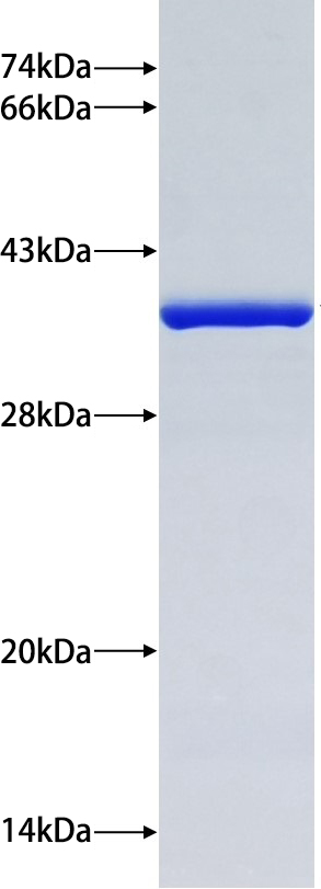 Recombinant Human ISLR SDS-PAGE