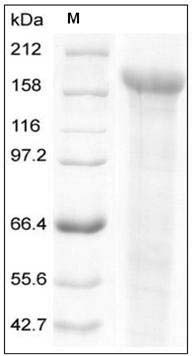 Human JAG1 / Jagged 1 / CD339 Protein (His Tag) SDS-PAGE