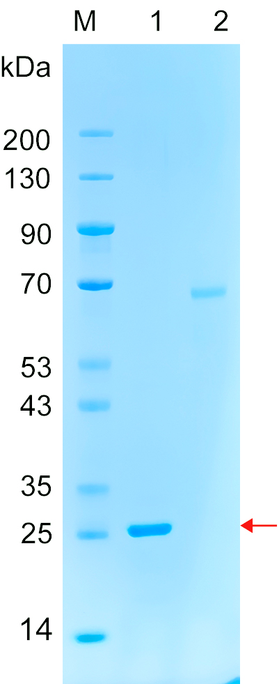 Recombinant CCPG1 protein (His tag) SDS-PAGE