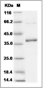 Human MKK6 / MEK6 / MAP2K6 Protein (207 Asp, 211 Asp) SDS-PAGE