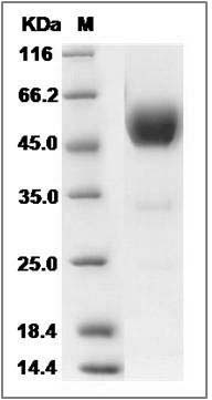 Human SIGIRR / TIR8 Protein (Fc Tag) SDS-PAGE