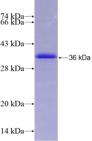 Recombinant Human RORA SDS-PAGE