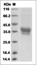 Cynomolgus IL20RB Protein (His Tag)