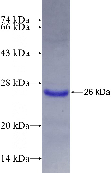 Recombinant Human SOCS2 SDS-PAGE