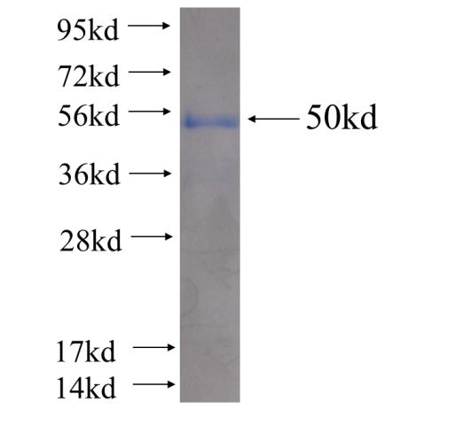 Recombinant human DNAJB5(Full length) SDS-PAGE