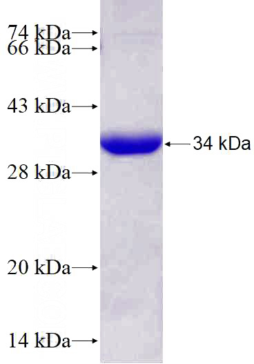 Recombinant Human RASEF SDS-PAGE