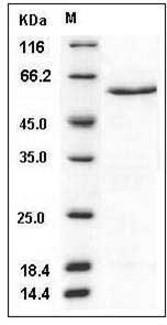 Human CDK5 Protein (GST Tag) SDS-PAGE