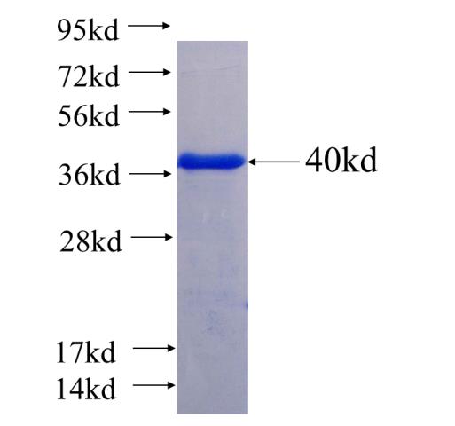 Recombinant human ANKRD57 SDS-PAGE