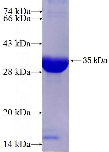 Recombinant Human CITED2 SDS-PAGE