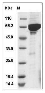 Human VRK1 Protein (His & GST Tag) SDS-PAGE