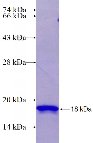 Recombinant Human RAB37 SDS-PAGE