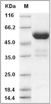 Human PPIase / FKBP7 Protein (Fc Tag) SDS-PAGE