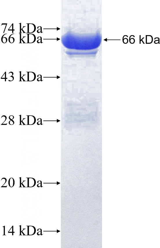 Recombinant Human PPP5C SDS-PAGE