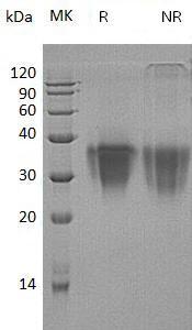 Human TWSG1/TSG/PSEC0250 (His tag) recombinant protein