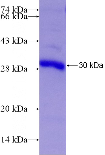 Recombinant Human RGS2 SDS-PAGE