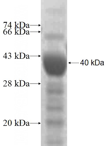 Recombinant Human UGCGL1 SDS-PAGE