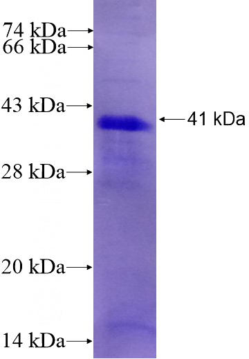 Recombinant Human LINGO1 SDS-PAGE