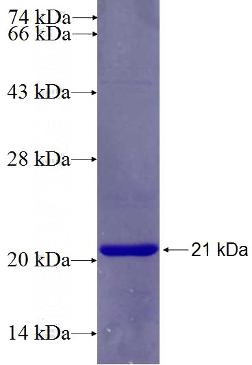Recombinant Human GTF3C2 SDS-PAGE