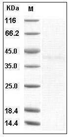 Human CD122 / IL-2RB recombinant protein