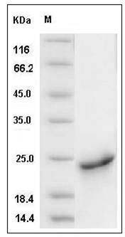 Human SHH / Sonic hedgehog Protein (aa 1-197, His Tag) SDS-PAGE