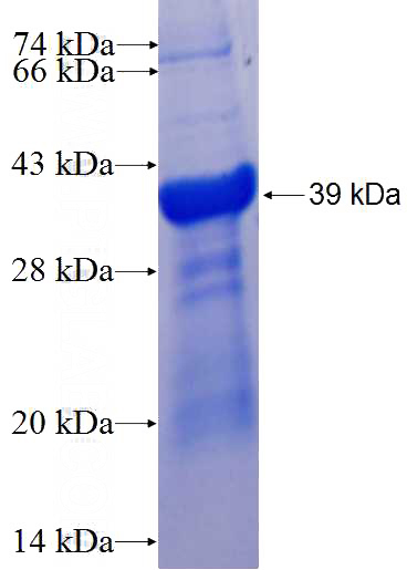 Recombinant Human PLG SDS-PAGE