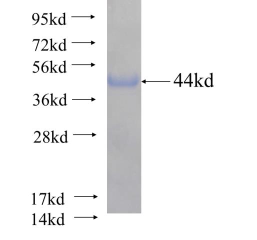 Recombinant human ALPK1 SDS-PAGE