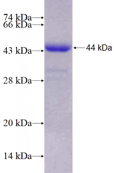 Recombinant Human MCC SDS-PAGE
