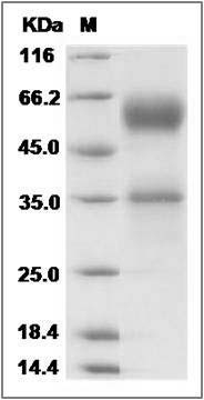 Rat FAS / CD95 / APO-1 / TNFRSF6 Protein (Fc Tag) SDS-PAGE