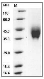 Mouse IFNGR2 Protein (His Tag) SDS-PAGE