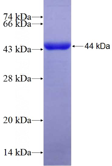 Recombinant Human CDH13 SDS-PAGE