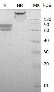 Human IL2RA (Fc tag) recombinant protein