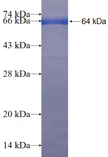 Recombinant Human LPCAT1 SDS-PAGE