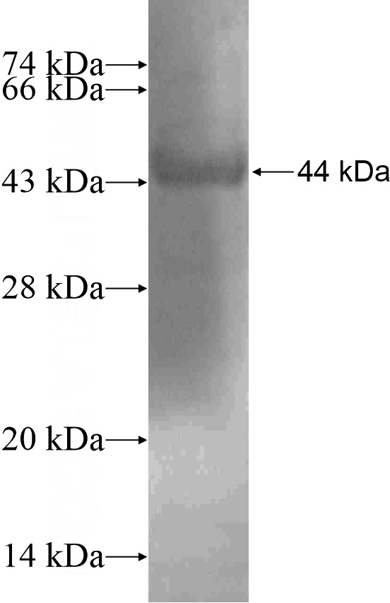 Recombinant Human CD109 SDS-PAGE