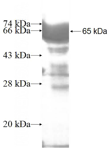 Recombinant Human U2AF2 SDS-PAGE