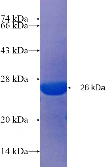 Recombinant Human SLC22A7 SDS-PAGE