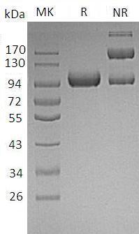 Mouse Lrig1 (His tag) recombinant protein