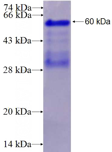 Recombinant Human VWCE SDS-PAGE