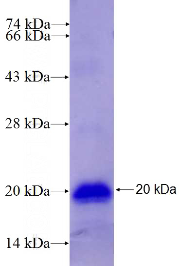 Recombinant Human GZMK SDS-PAGE