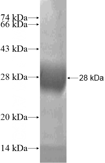 Recombinant Human NDUFS8 SDS-PAGE