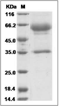 Cynomolgus TIM3 / HAVCR2 Protein (Fc Tag) SDS-PAGE