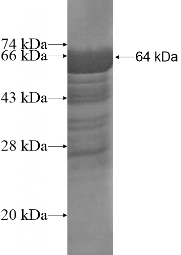 Recombinant Human SH3BP1 SDS-PAGE