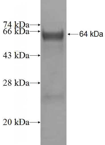 Recombinant Human CIRH1A SDS-PAGE