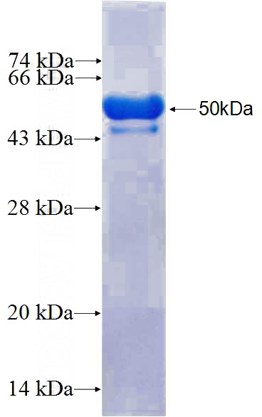 Recombinant Human TIAM1 SDS-PAGE