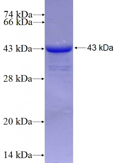 Recombinant Human GGA1 SDS-PAGE