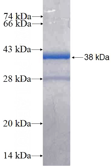 Recombinant Human PDXP SDS-PAGE