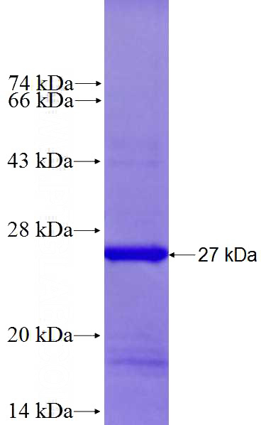 Recombinant Human RAB39B SDS-PAGE