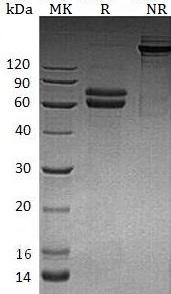 Human JAM2/C21orf43/VEJAM/UNQ219/PRO245 (Fc tag) recombinant protein