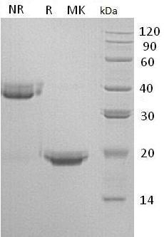 Human IL17F (His tag) recombinant protein