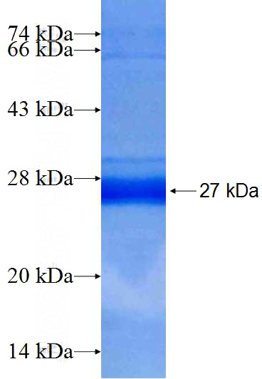 Recombinant Human SDS SDS-PAGE