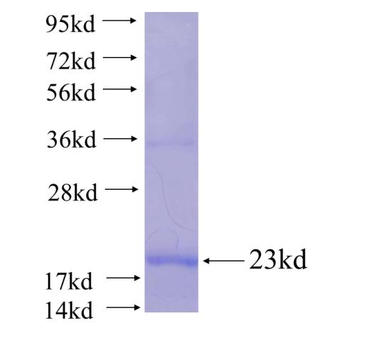 Recombinant human BBS10 SDS-PAGE